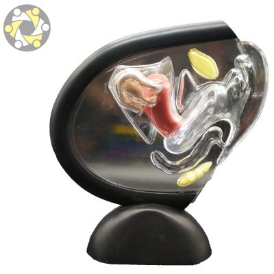 China New design education pathological transparent female system model of uterus teaching for sale