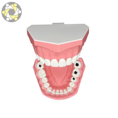 China Dental Education High Quality Durable Plastic Tooth Dental Teaching Model for sale