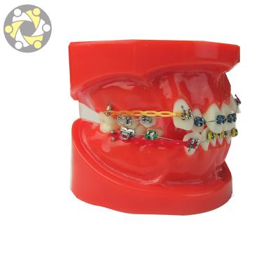 China Education Orthodontic Model With Metal Bracket Dental Study Model for sale