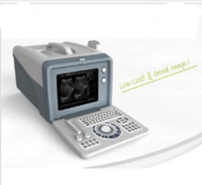 China Cheap Plus Acrylic Medical Ultrasound Scanner Handheld Laptop On Sale All Digital And Clearer Image Medical Ultrasound for sale