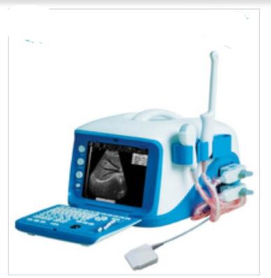 China acrylic ultrasound scanner machine price with high quality for sale