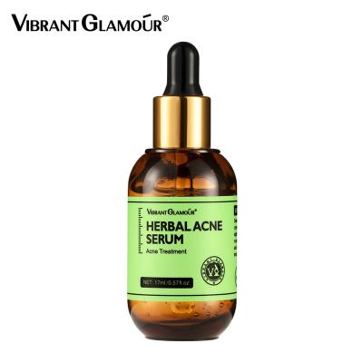 China Acne Treatment Private Logo Organic Gentle Skin Care Acne Removing Herbal Treatment Serum OEM Acne Serum for sale