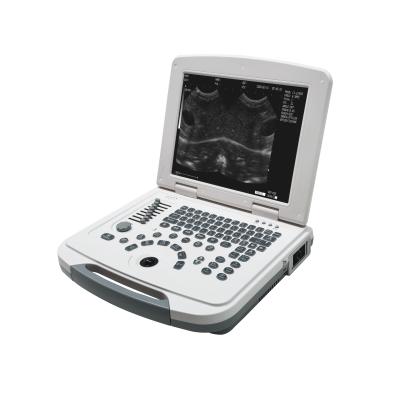 China Dawei Portable Veterinary Ultrasound Animal Health Goat Diagnosis for Cow Pig Pregnancy Near Me for sale