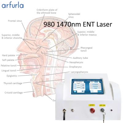 China Liposuction Surgical Surgery Laser Weight Loss Arfurla Diode Otolaryngology Otolaryngology Dental Tooth Whitening Treatment for sale