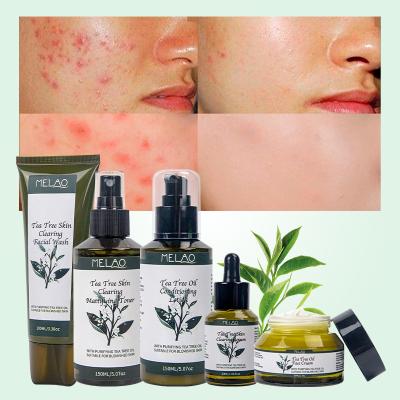 China Anti Acne Whitening Organic Cleansing Kit Acne Treatment Set QQLR Face Private Label Tea Tree For Skin Care for sale