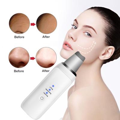 China New Arrival USB Ultrasonic Face Skin DEEP CLEANING Cleansing Scrubber Peeling Pore Remover Face Scrubber for sale