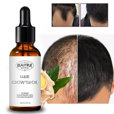 China Low MOQ Color-Protection Customized Hair Growth Oil Products Treatment Grow Serum Ginger Hair Growth Oil for sale