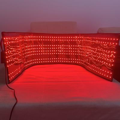 China Blood Vessel Removal Factory Direct Selling Pulse Led Therapy 660nm 850nm Therapy Wrap Light Redlight Belt for sale