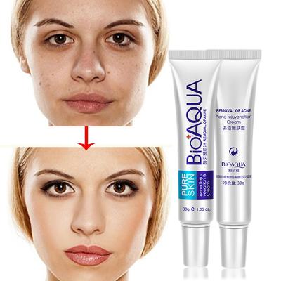 China Effective Skin Revitalizer Acne Removal Cream Acne Treatment Fade Spots Skin Care Cream for sale