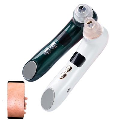 China Wholesale Facial Blackhead Remover Acne Primer Vacuum Pore Remover Acne Treatment Blackhead Visible Blackhead Remover for sale