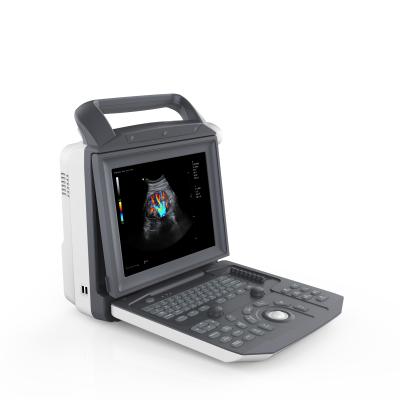 China ZONCARE Technology PC Base Portable Ultrasound Diagnostic Multi-beam Dynamic Hospital 3d Ultrasound Scanner for sale