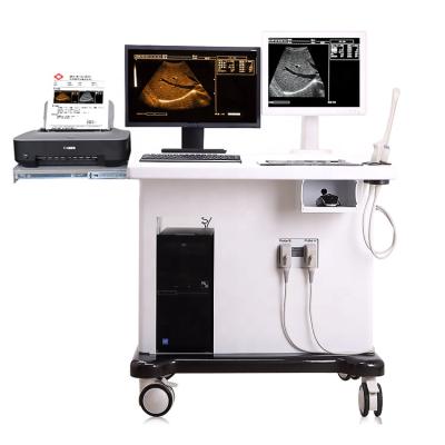 China Professional Metal China Manufacture Digital Trolley Ultrasound Scanner With Workstation for sale