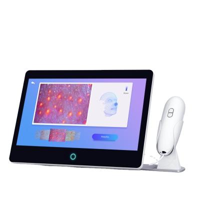 China Portable Acne Analysis Device New Arrival 3D Skin Analyzer Technology Facial Skin Moisture Analyzer for sale