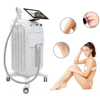 China New Hair Removal Technology Alma Soprano Nose Hair Removal 3 Waves Diode Laser 755nm 808nm 1064nm Titanium Hair Removal Laser for sale