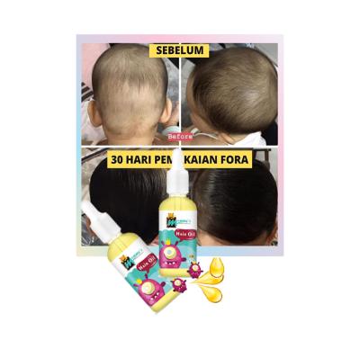 China Top 10 Hair Loss Prevention Discount Extreme Fast Hair Growth Oil Great For Thin Baby Hair for sale