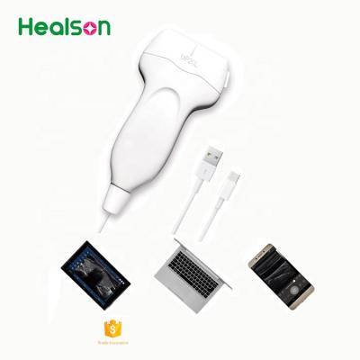 中国 Healson UP20 Linear ecografo portatil handheld ultrasound machine for Android /linear ultrasound probe/laptop probe ultrasound 販売のため