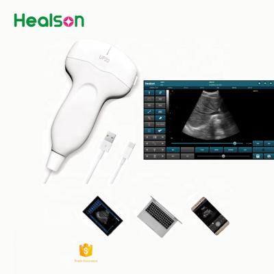 China Healson UP20 cheapest USB portable ultrasound machine /usb ultrasound probe for sale