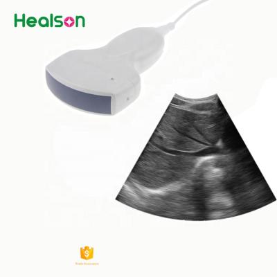 中国 UP20 Therapeutic Ultrasound Machine Usb Portable Ultrasound Machine For Phones/Laptop/Computer 販売のため