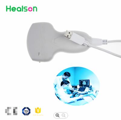 China Convex Therapeutic Ultrasound Machine Clinic Smartphone/Mobilephone Ultrasound Machine/System For Abdomen/Urology/OB/GYN for sale