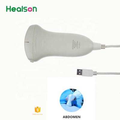 中国 USB Digital Ultrasound Machine Portable Ultrasound System/Machine/Probe For Icu/Msk/Emergency/Abdomen Ultrasound Probe 販売のため