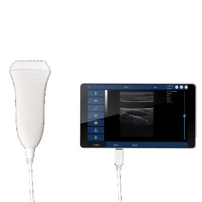 中国 U20L Digital Ultrasound Machine Electric Linear Digital Usb Portable Ultrasound Machine 販売のため