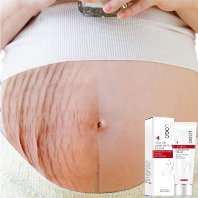 China Wholesale Pregnancy Mark Cream Anti Stretch Mark Creme Skin Revitalizer Stretch Marks Natural Stretch Mark Removal Cream Treatment Lotion Skin Care for sale