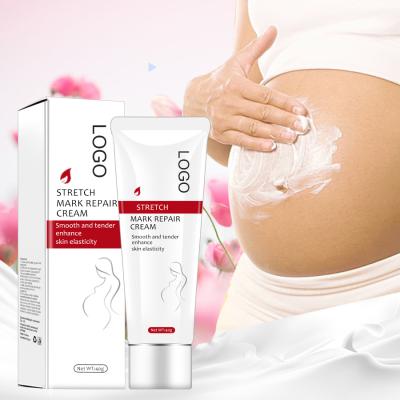 China Skin Revitalizer Private Label Pregnancy Stretch Mark Removal Cream 40g Acne Scar Repair Products Spill Stretch Mark Remover Cream for sale