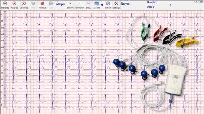 China 12 Lead Ambulatory Handheld ECG Machine For Vales & Hills Grey ECG Acquisition Box for sale