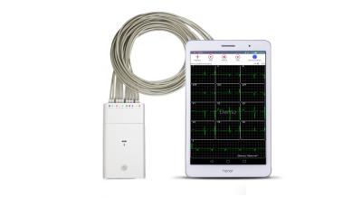 China White ECG Signal Recorder Andriod System Bluetooth ECG Machine for sale