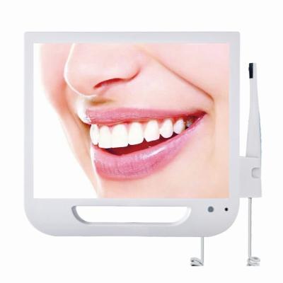 China 17 Inch LED Screen Dental Endoscope Factory High Pixel Intra Oral Camera With Wifi for sale