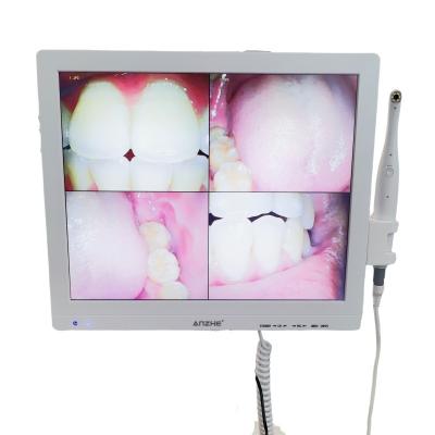 China Wifi todo en una cámara oral con altavoz pantalla LCD escáner de cámara oral dental en venta