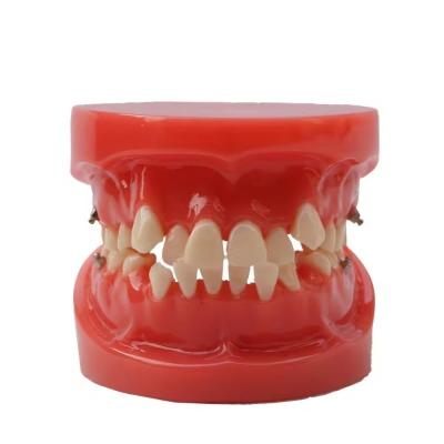 China Formación Uso de los dientes dentales Modelo de enseñanza Funcional Modelo de ortodoncia dental sin soporte en venta