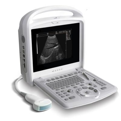 China Hospital Hot Selling Portable Ultrasound Machine Laptop Computer Ultrasound Machine Portable Ultrasound for sale