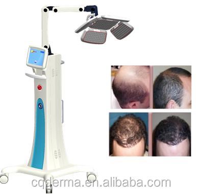 China Multi Function Anti-hair Loss System For Acne Treatment for sale