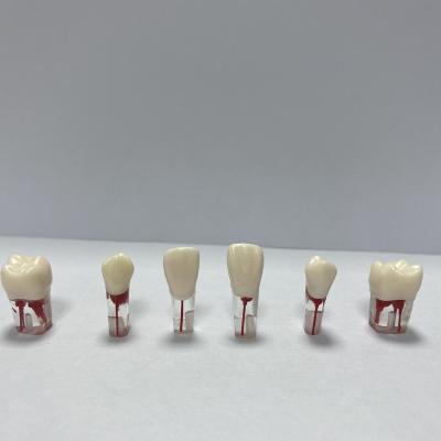 China Fix on Dental Endo Root Canal Files Pulp Tooth Model Chair Resin Dental Endodontic Practice for sale