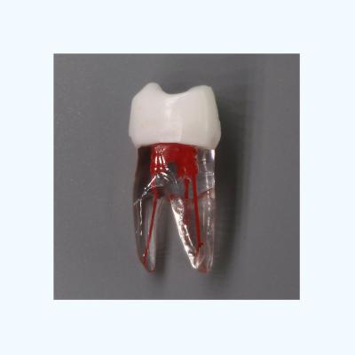 China Fix On Dental Chair Supplies Nissin Educational Type Accessed Root Canal Dental Teeth With Pulp Cavity For Anatomical Type Practice Endodontics Mode for sale