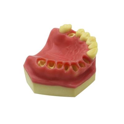 China Resin Wax Nissin Typodont Study Cavity Preparation Training Practice Dental Model for sale