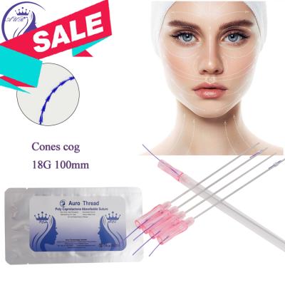 China Easy to use 18G 100mm tooth cones beauty pdo fios face cheek cheek lift medical v shape absorbable suture barbed lift for mesotherapy for sale