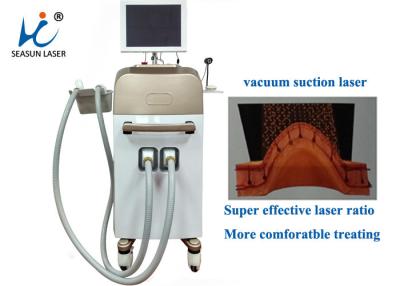 Cina Depilazione del diodo del duetto di Lightsheer di terapia laser di vuoto permanente per il fronte in vendita