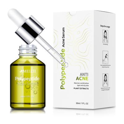 China Custom Acne Polypeptide Anti-Puffiness Lysine Aging Moisturizing Serum Anti Wrinkle Skin Repair Care Acne Pimple Whitening Anti Marks Face Serum for sale