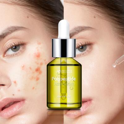 China Anti-Puffiness Ameizii Wrinkle Anti Moisturizing Whitening Polypeptide Skin Repairing Pimple Remover Treatment Anti Acne Facial Herbal Serums for sale