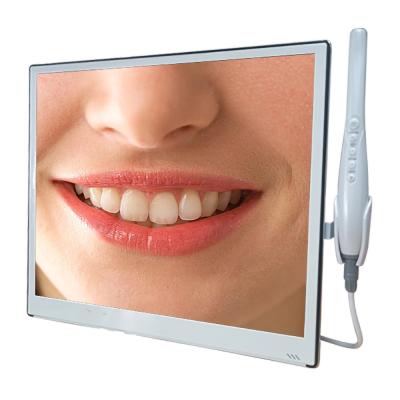 China AliGan dental equipment metal 17 inch built-in monitor wifi oral camera intra with remote control for sale