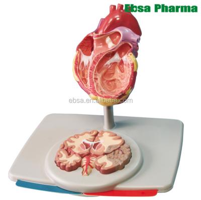 China PVC Advanced Medical Supplies Human Teaching Hypertension / High Cholesterol - Heart And Brain Model for sale