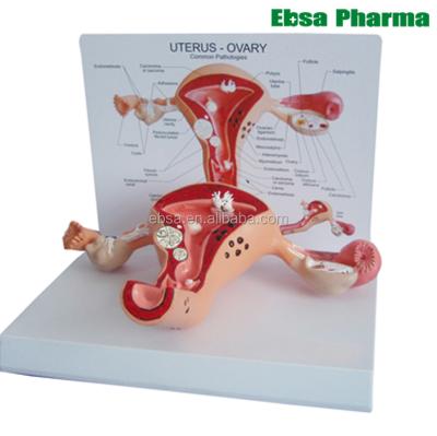 China PVC Advanced Medical Supplies Human Teaching Uterus Anatomical Model for sale