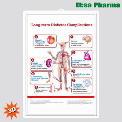 China PVC 3D Medical Human Anatomy Wall Charts / Posters-Long-Term Diabetes Complications for sale