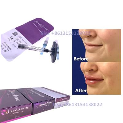 中国 注入口のJuvedermの注射可能な皮膚スポイトUltra3 Ultra4 Voluma 販売のため