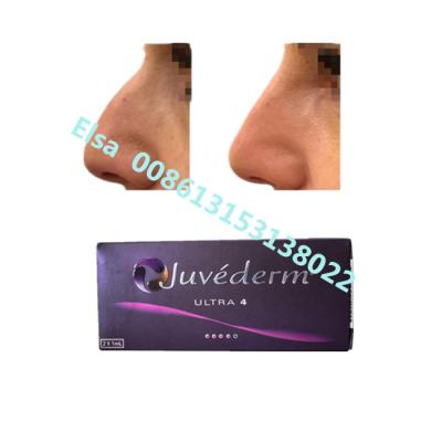 中国 Juvederm ナトリウム 超4 ボリュマ 皮膚 フィルラー 販売のため