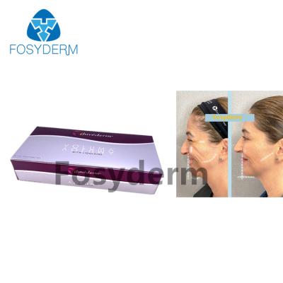 Chine Remodelez l'injection cutanée de Juvederm Voluma 2*1ml de remplisseur d'ha de découpe faciale à vendre