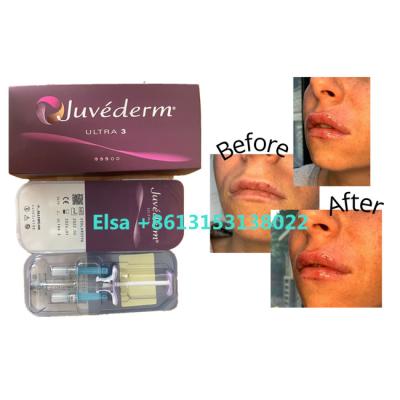 China Hautfüller kosmetische Produkte Juvederm für Gesichts-Lippen zu verkaufen