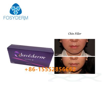 China Chin Augmentation Hyaluronic Acid Facial-Vuller Juvederm Ultra4 Huid2ml Te koop